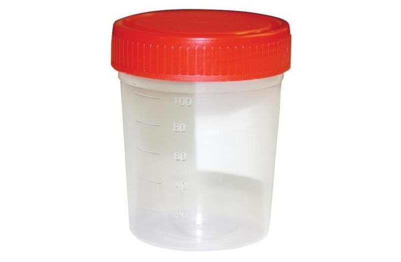 Urine Container